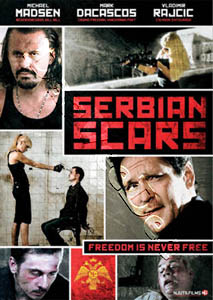 Serbian Scars (DVD)